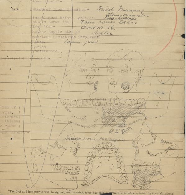 Detailed Wound Diagram